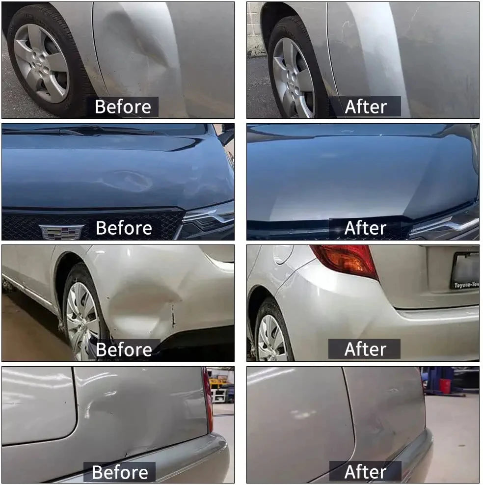 Paintless Dent Repair Kit for Cars – Hail Dent Puller with Glue Gun - image 2