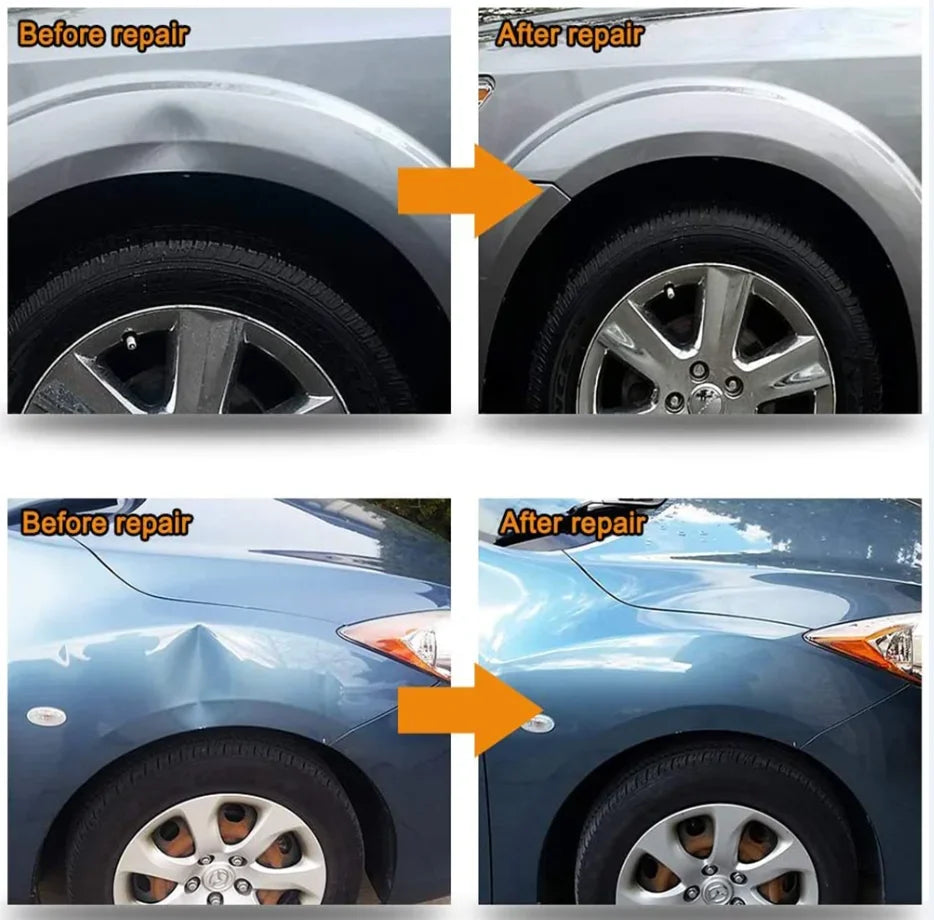 Paintless Dent Repair Kit with Glue Gun and Dent Pullers