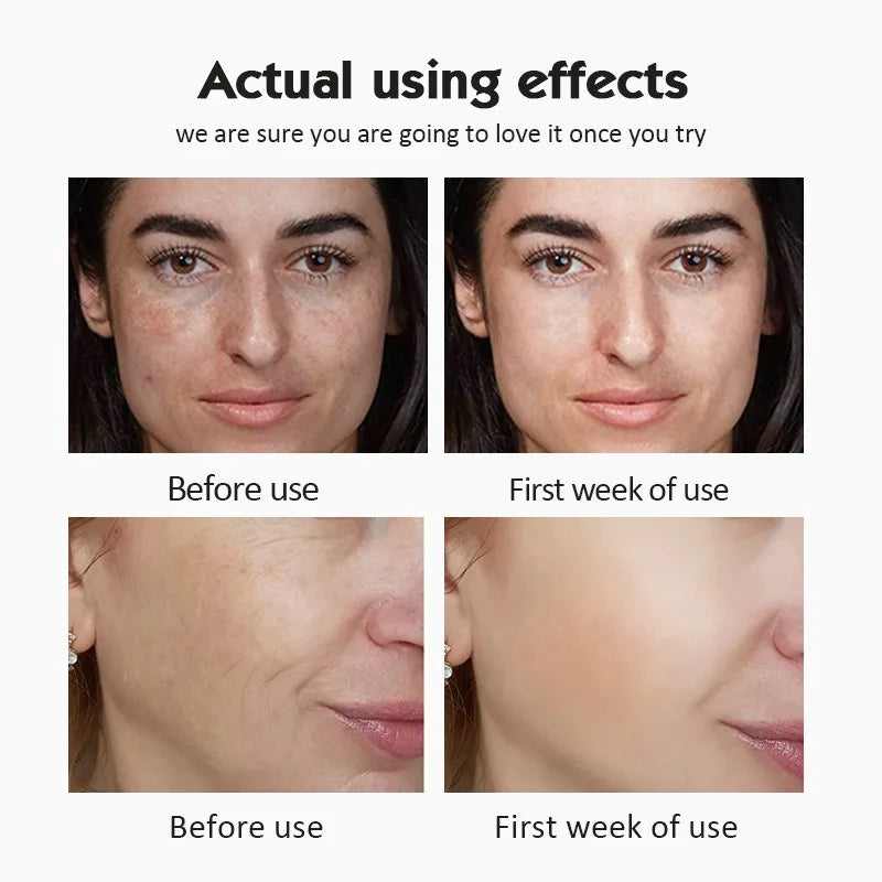 20% Vitamin C Serum Set for Radiant Skin & Anti-Aging - image 2