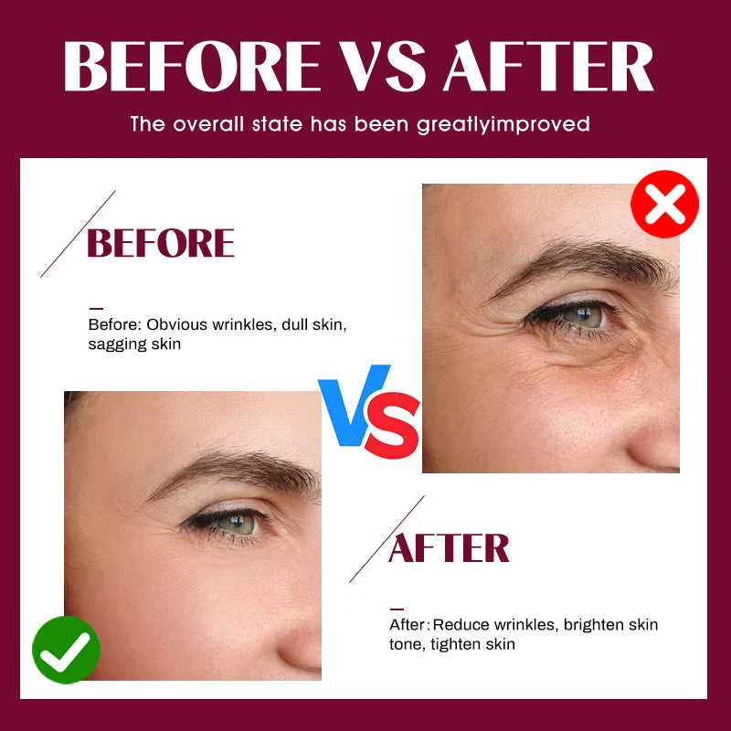6 Peptide Hyaluronic Acid Serum – Acne Solution & Anti-Aging - image 5