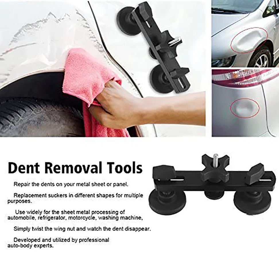 Paintless Dent Repair Kit with Glue Gun and Dent Pullers