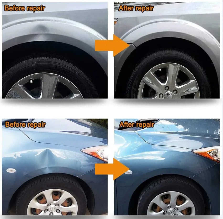 Paintless Dent Repair Kit with Glue Gun and Dent Pullers