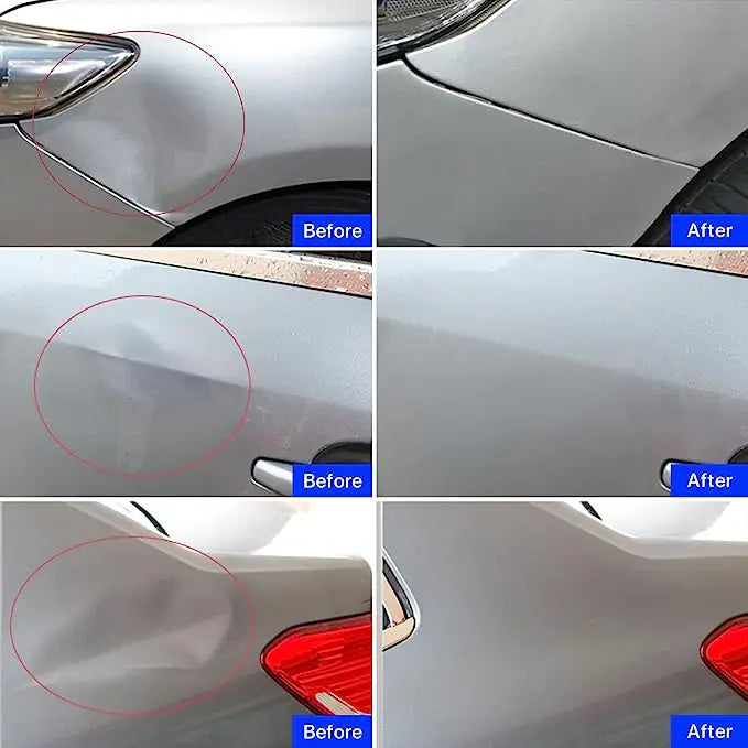 Paintless Dent Repair Puller Kit, Suction Cup Set
